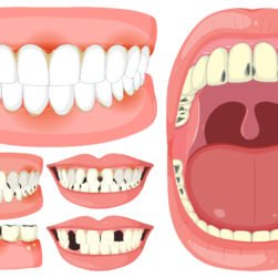 Vector illustration of various dental conditions and treatments