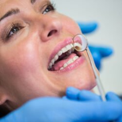 Close-up of doctor examining female patients teeth with the mouth mirror