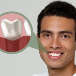Happy African American man with perfect teeth smiling on light grey background. Illustration of dental implant