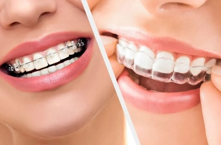 Top Orthodontist in San Antonio, TX – Trusted by Families!